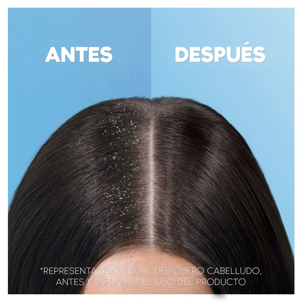 Champú Head & Shoulders H&S Refreshing Menthol 1 L-4